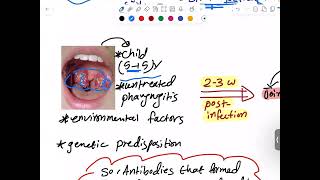 CVS Pathology  Rheumatic Heart Disease  RHD   Mutah [upl. by Clute160]