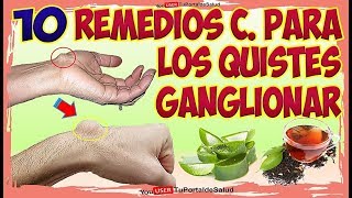 10 Remedios Caseros para Quistes Ganglionar  Como Aliviar Quistes Ganglio [upl. by Jesus125]