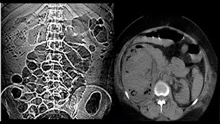 Genitourinary Radiology cases 15SpottersradiopediaGUCTMRIplainxrayIVPultrasoundradiologie [upl. by Worth]