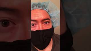 Pterygium Removal Surgery Before and After  Dr Franz Michel  2 of 3 [upl. by Alegnave14]