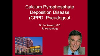 10 Calcium Pyrophosphate Deposition Disease Pseudogout [upl. by Nomelif]