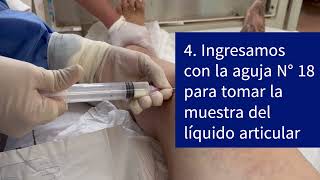 Artrocentesis de rodilla cara externa procedimiento artritis procedure medicine arthritis [upl. by Jump]