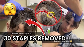 NIDAL IS GETTING STAPLES REMOVED FROM HIS HEAD🫣 Doctor checkup [upl. by Tnert]