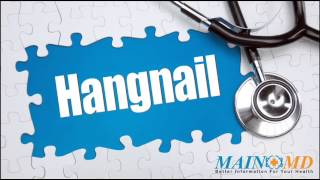 Hangnail ¦ Treatment and Symptoms [upl. by Sterrett]