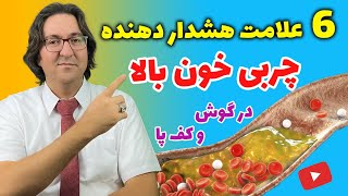 نشانه ها، علل و درمان چربی خون بالا، کبد چرب، گرفتگی و انسداد عروق به روش دکتر جاوید در 14 روز [upl. by Springer466]