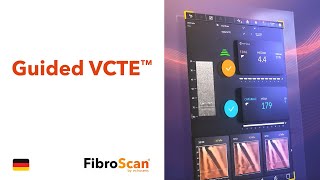 Guided VCTE™  FibroScan® [upl. by Madelle]