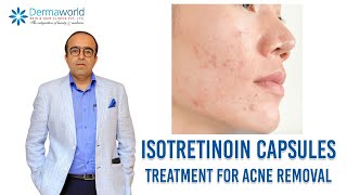 Isotretinoin capsules  Treatment for Acne removal  In Hindi  Dr Rohit Batra [upl. by Blockus49]