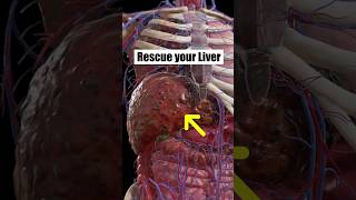 Safer Ways to Support Liver liverhealth healthtips [upl. by Swift]