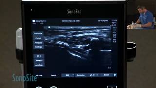 Ultrasound Guided Brachial Plexus Nerve Block in a Dog Part 3 of 3 [upl. by Eibob]