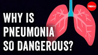 Why is pneumonia so dangerous  Eve Gaus and Vanessa Ruiz [upl. by Magocsi]