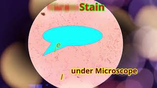 Klebsiella under Microscope Klebsiella Gram Stain [upl. by Eibbed]