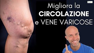 VARICI cattiva circolazione VENE VARICOSE 👉 consigli pratici [upl. by Dolphin]