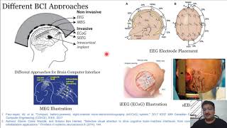 65 Recent Trends Microelectrode Arrays and Deep Brain Stimulation [upl. by Grega286]