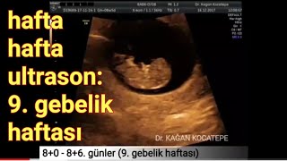 9 gebelik haftasında anne karnındaki bebek  açıklamalı ultrason görüntüleri [upl. by Adnoluy]