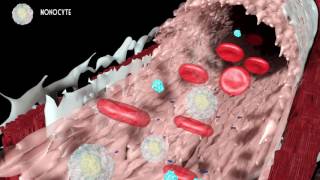 Development of atherosclerosis [upl. by Atirres]