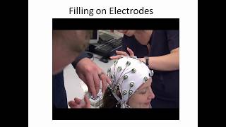 How to perform an EEG experiment [upl. by Celina]