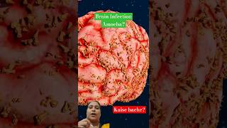 Naegleria Fowleri viralvideo science facts shortfeed shorts [upl. by Hcnarb46]