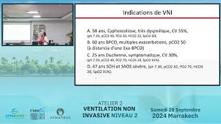 Comment régler un ventilateur  Modes deventilation modes de contrôle des cycles [upl. by Ynohtnaed]