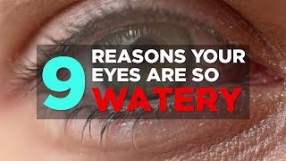 9 Reasons Your Eyes Are So Watery  Health [upl. by Ehtyaf]