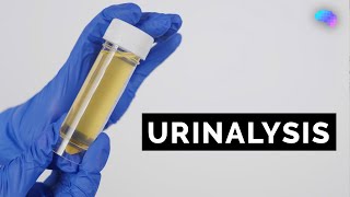 Urinalysis  Urine Dipstick Test  OSCE Guide  UKMLA  CPSA [upl. by Lindsey838]