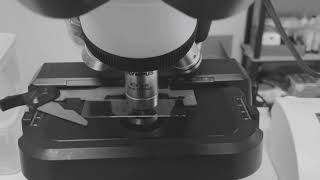 Urine Sediment Cell Identification Clinical Microscopy 🔬🦠 [upl. by Ire]