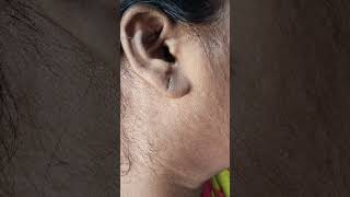 Ear lobe correction 22yearsofsalonexperience [upl. by Noimad]