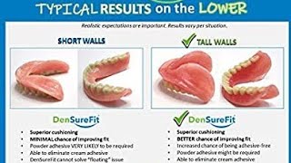 DENSUREFIT SOFT RELINE Bottom Denture densurefit denturewearers dentures [upl. by Coad]