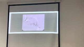 11167 Salivary gland disorder  soft tissue opacities  ไม่ได้ถ่ายบท TMJ abnormalities [upl. by Kred]