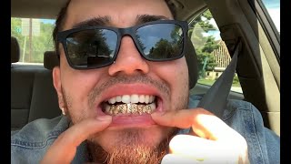 Custom Gold Grillz Review CUSTOMFIT Solid Gold Deep Cut Grillz [upl. by Bern386]