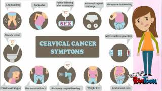 Endocervical Adenocarcinoma [upl. by Ateerys]