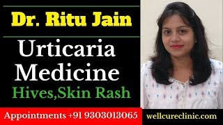 UrticariaHomeopathic Medicine for Urticaria HivesSkin Bumps Rashes Itching Allergic Skin [upl. by Wooldridge]