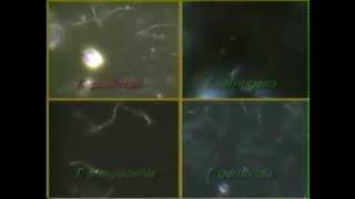 Treponema Syphilis Darkfield Video CDC [upl. by Gunas]