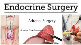 Endocrine Surgery 7 [upl. by Otreblif]