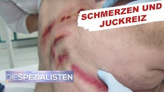 Krasser Hautausschlag  Auf Streife  Die Spezialisten  SAT1 TV [upl. by Asilav]