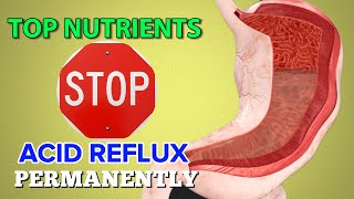 5 Vitamins  Minerals to Stop Acid Reflux Permanently [upl. by Magdau]