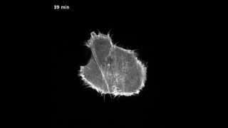 Actin dynamic during cell division [upl. by Annatsirhc]