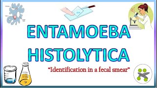 Entamoeba Histolytica  Morphology of the Trophozoite amp Cyst on Light Microscope Stools for AOC [upl. by Terces232]