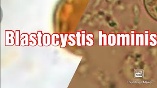 Skill Lab12 Blastocystis hominis [upl. by Wilcox]