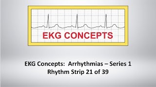 EKG Concepts Arrhythmias Course  Strip 21 of 39 [upl. by Estella]