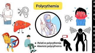 Polycythemia  Relative polycythemia  Absolute polycythemia  Polycythemia Vera [upl. by Okiron]