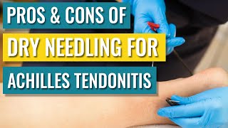 Dry Needling For Achilles Tendinopathy  Tendonitis — Does It Help [upl. by Timmie]