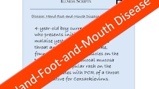 HandFootandMouth Disease Coxsackie Virus Illness Script  USMLE Pediatrics [upl. by Attenohs]