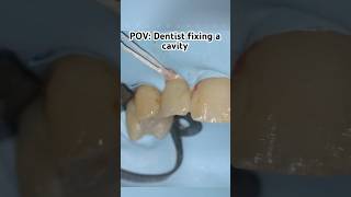 Fixing a cavity dentist pov satisfying [upl. by Jewett]