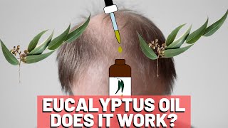 Eucalyptus Oil For Hair Growth  Does It HELP [upl. by Iah]