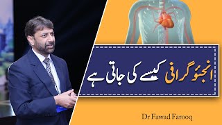 Angiography how kaisay ki jati hay by DrFawad Farooq Urdu [upl. by Cass]