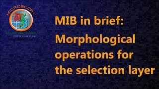 MIB in brief Morphological operations for the selection layer [upl. by Kristofer]