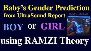 Baby boy symptoms during pregnancy from Ultrasound Report using Ramzi Theory in English [upl. by Arliene]