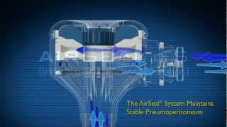 SurgiQuest How AirSeal Works [upl. by Neveda]