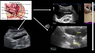 Echographie digestive visualisation du rectum Difficile [upl. by Norud]