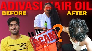 ADIVASI HAIR OIL SCAM  MY PERSONAL EXPERIENCE [upl. by Charlena838]